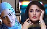 طناز طباطبایی چه جراحیهای زیبایی کرده است؟ / خانم بازیگر نچرال سینمای ایران عملی از آب درآمد ! + فیلم